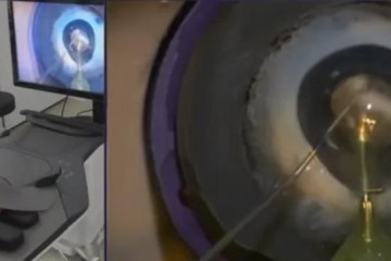 直覺外科創始人，加盟眼科手術機器人公司